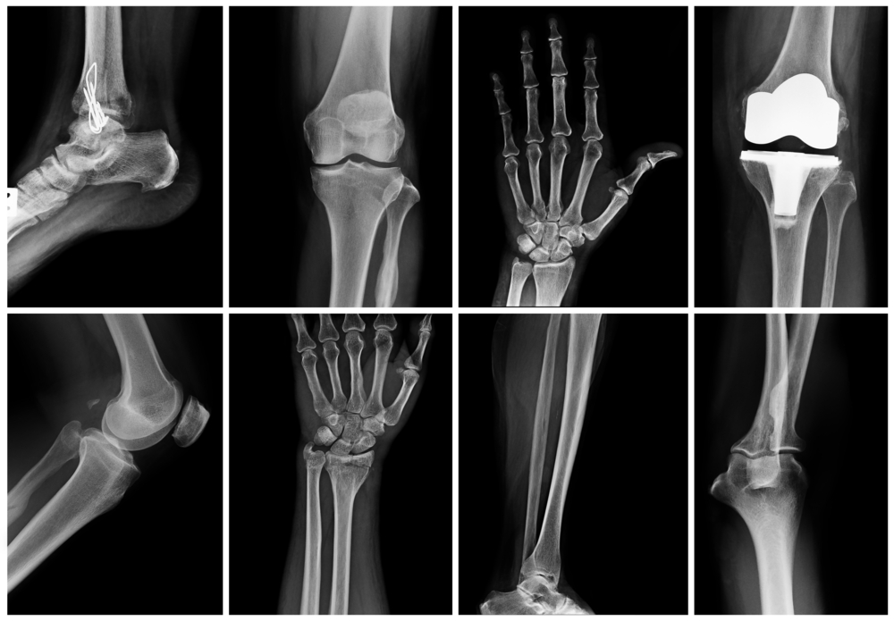 x ray collage