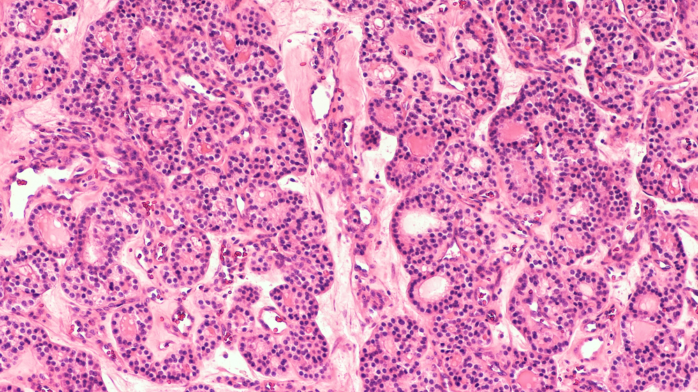 Cells under a microscope.