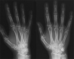 X-ray of two hands.