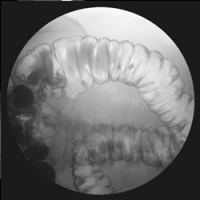 X-ray of the intestines.