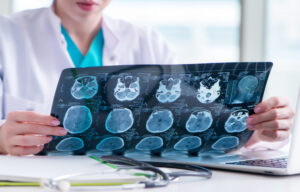 Doctor examining MRI image