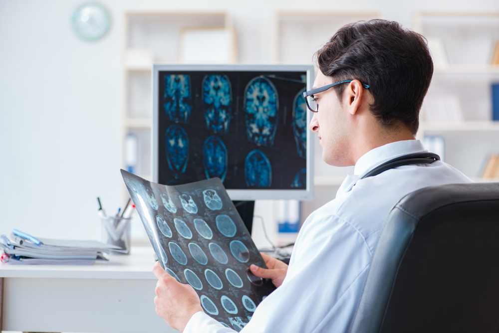 Radiologist reviewing a brain scan.