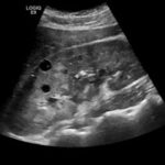 Ultrasound scan results.