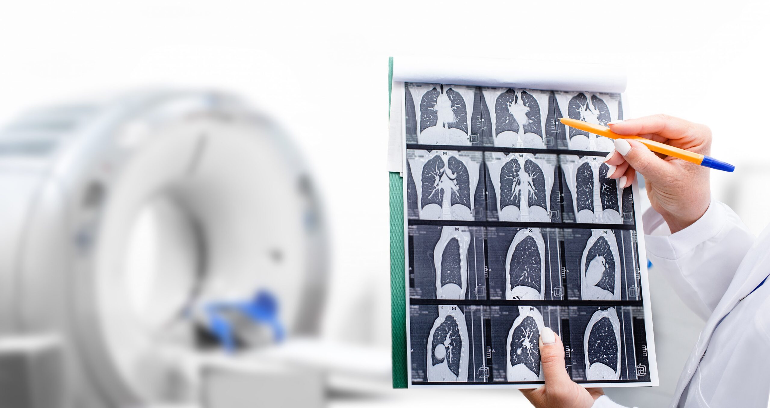 doctor reading lung ct scan.